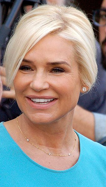 Yolanda Hadid with autoimmune disease - Lyme Disease